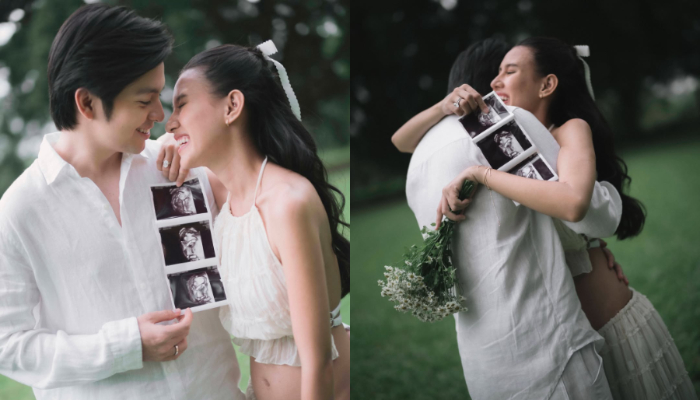 Angga Yunanda & Sheina Sambut Kehamilan Pertama